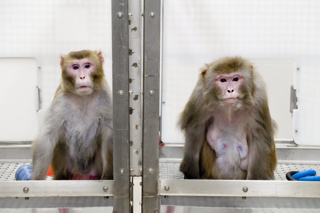 Elon Musk’s Neuralink shows video of monkey using mind to play Pong