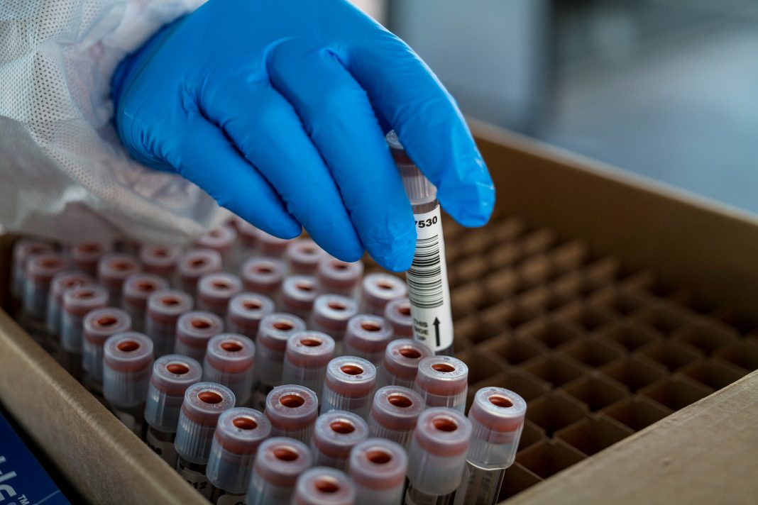Researchers identify five new cases of variant in California